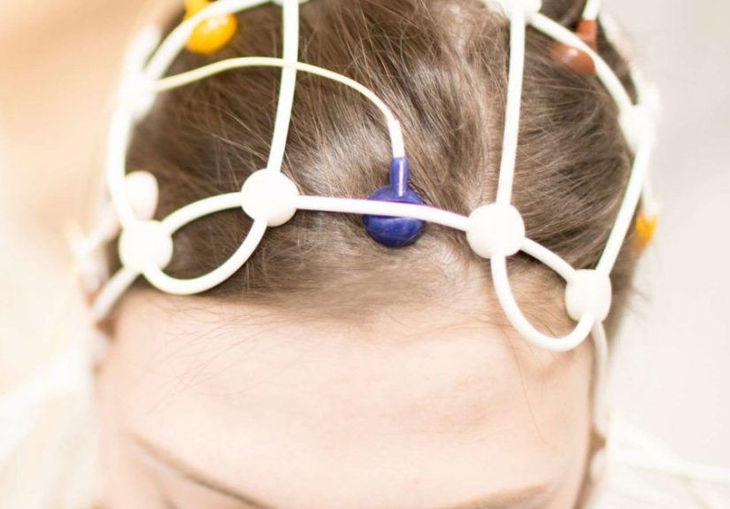 EEG (electroencephalogram) test: What to know