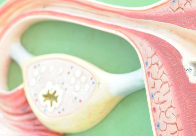 Ovarian cancer and cysts: What is the link?