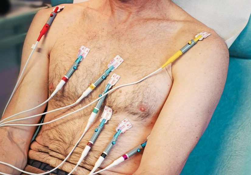 Complete Heart Block: Symptoms, Causes, Treatment, Outlook