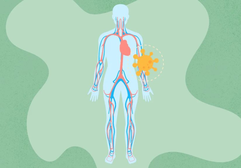COVID-19 Ages Blood Vessels by 5 Years for Women