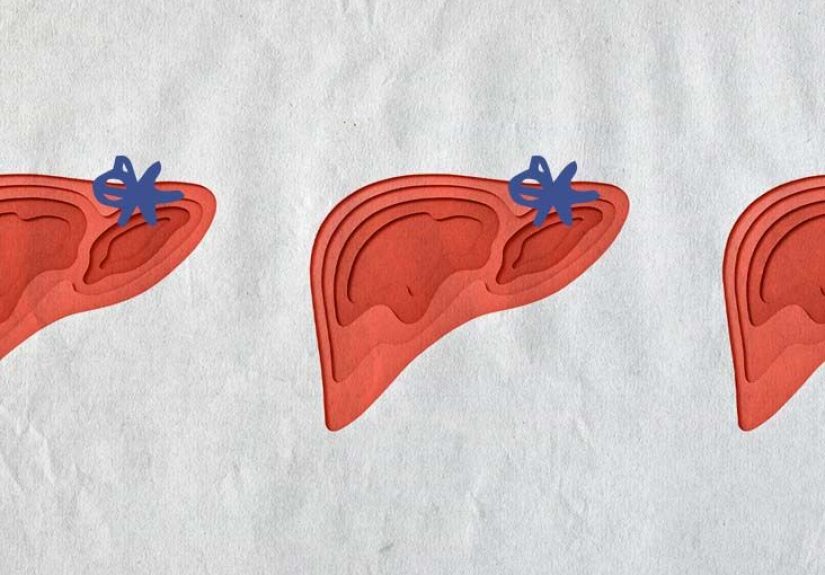 Elevated liver enzymes: Causes, symptoms, tests, and treatment