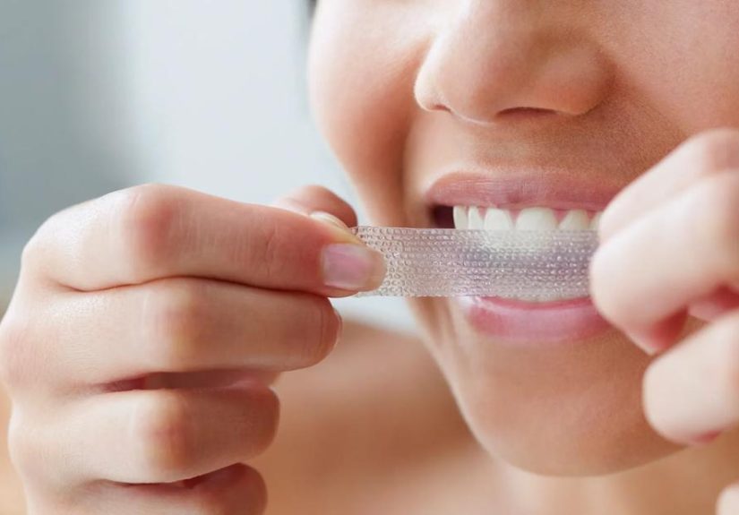 Is Teeth Whitening Safe (and Does It Work)?