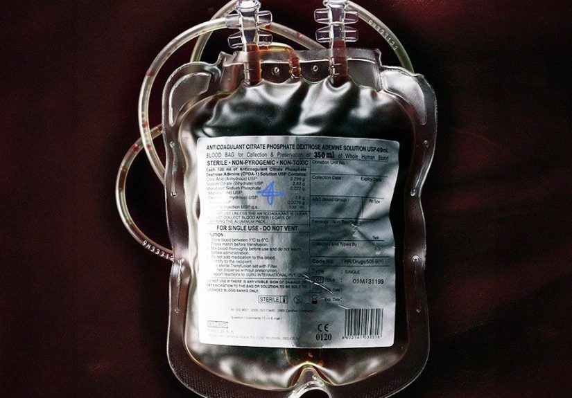 Acute blood loss anemia: Causes, symptoms, treatments