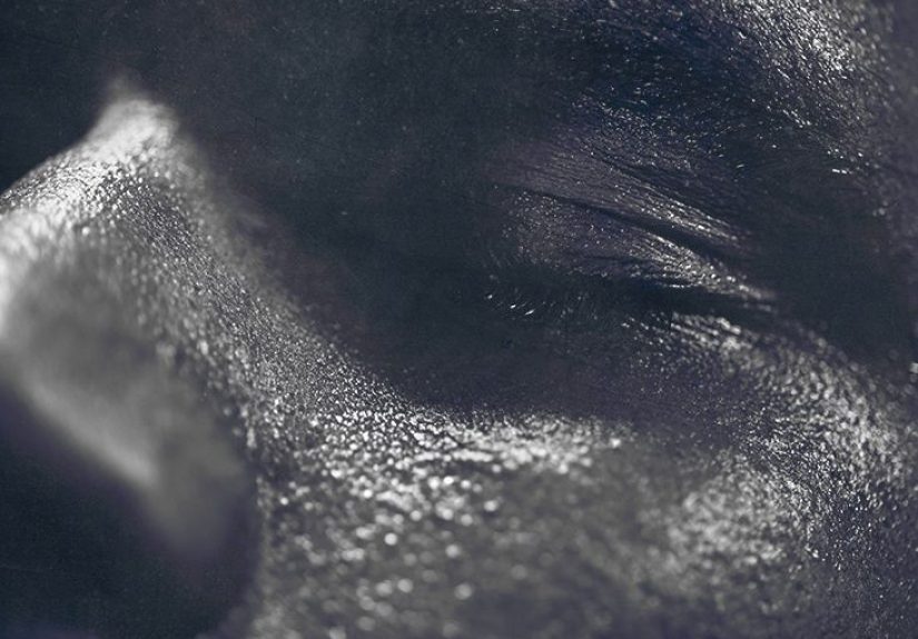 Are night sweats an early sign of leukemia?