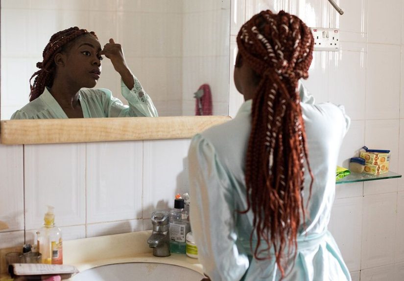 Asteatotic Eczema: Symptoms, Causes, Treatment and More