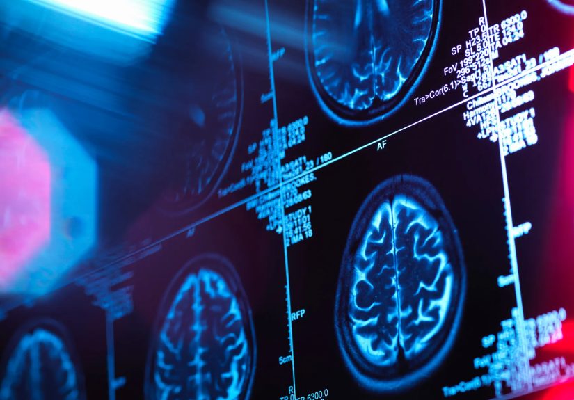 Brain Diseases, Disorders, & Conditions