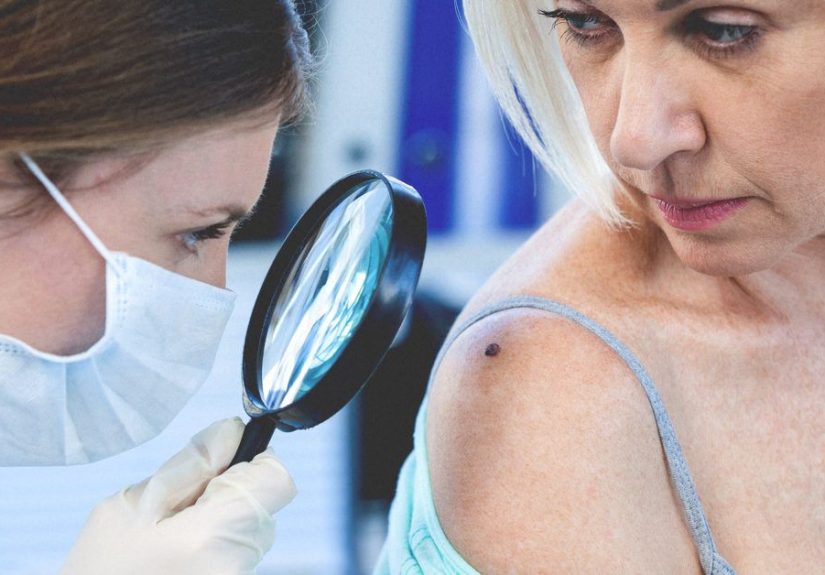 Carcinoma vs. Sarcoma: Location, Prevalence, and Prognosis