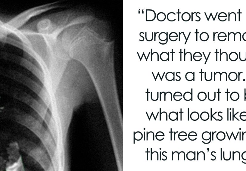 Guy Shares Disturbing Facts To “Ruin Your Day” And Here’s 35 Of The Most Upsetting Ones