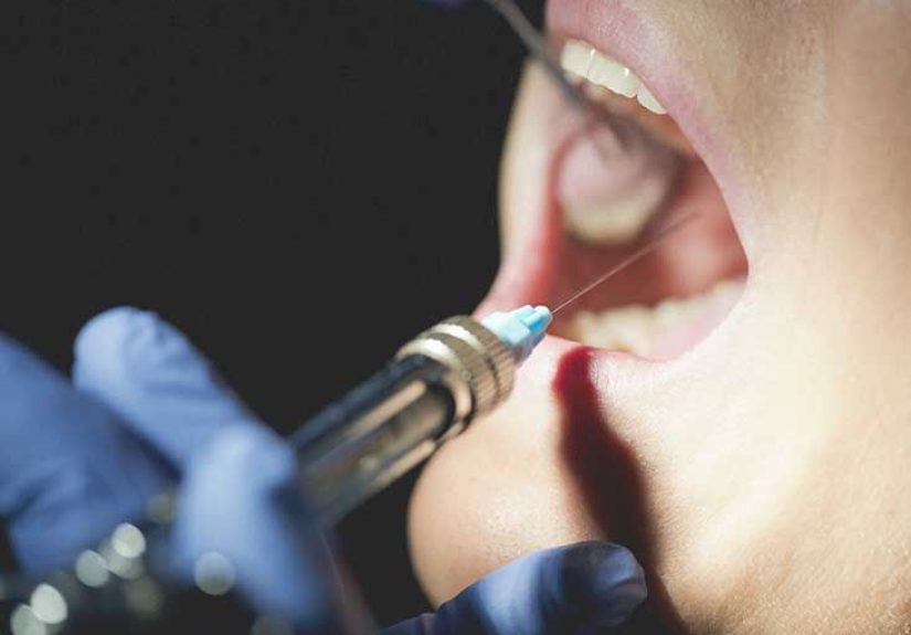 How Long Does Novocaine Last: Side Effects and More