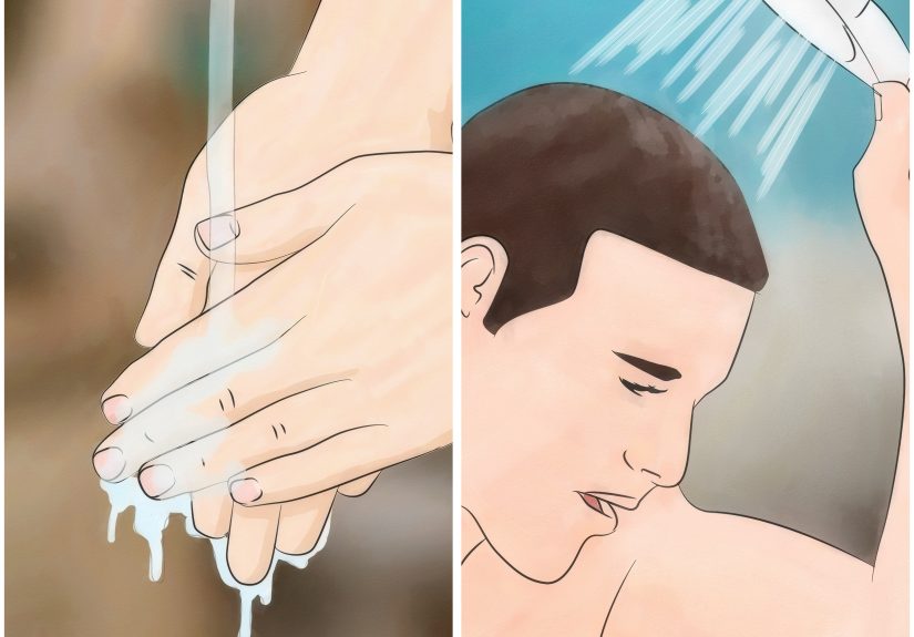 How to Get Rid of Pinworms: 13 Steps