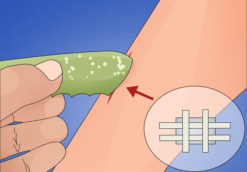 How to Make a Quick Disinfectant for Minor Cuts and Abrasions