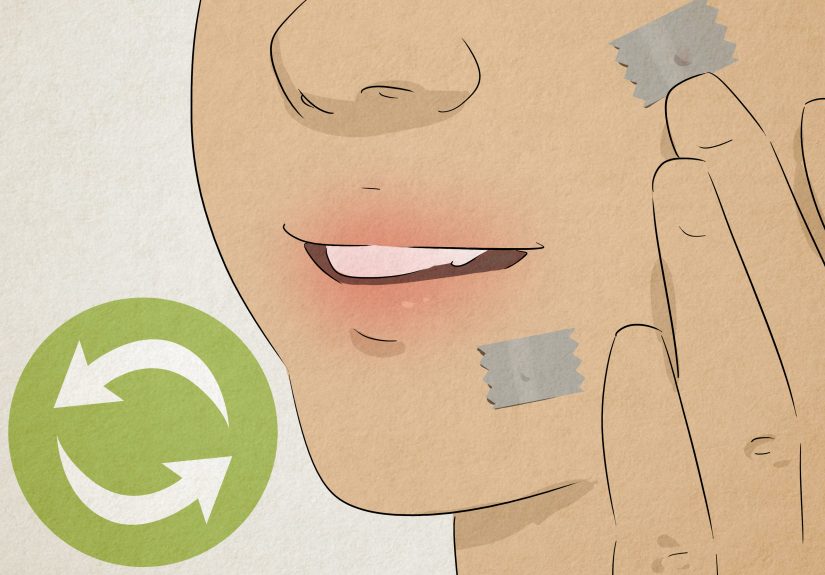 How to Remove a Wart With Duct Tape: 9 Steps