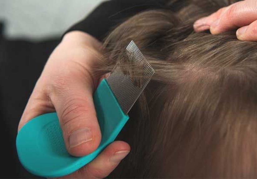 Lice Bites: How to Identify and Treat