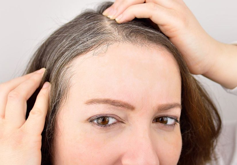 Mole on Scalp: Types of Moles, Risks, and Warning Signs of Melanoma