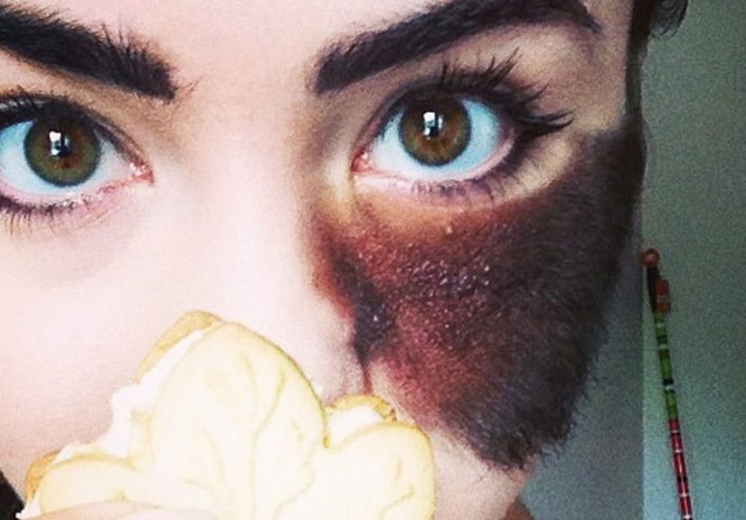 People Told Her To Remove Her Birthmark, But She Chose To Embrace It Instead