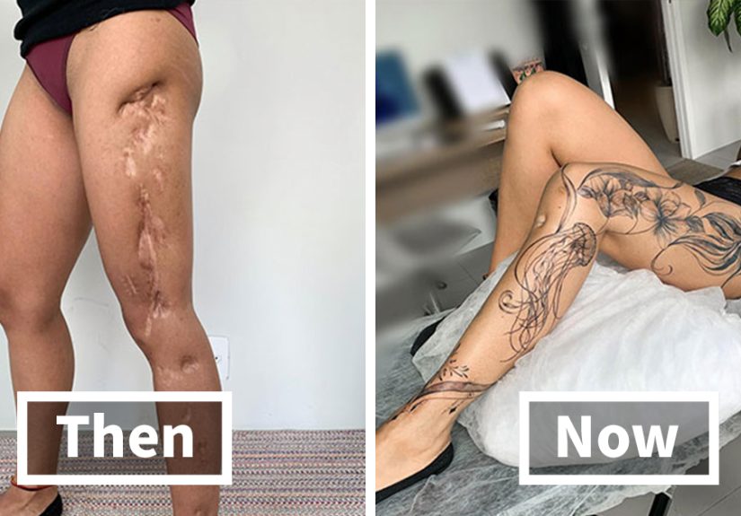 Tattoo Artist Covers Scars With Delicate Designs, And Here Are Her 30 Best Transformations