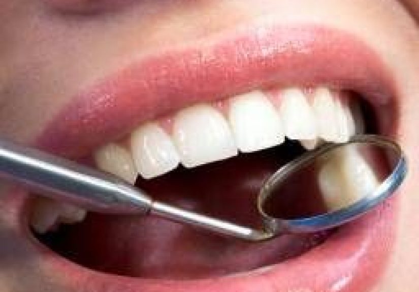 Teeth and gum care: How to brush teeth, what to eat, and dental decay