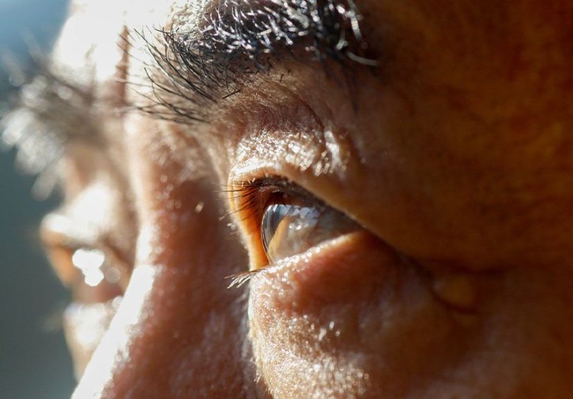 Treatment of Dry Eyes from Sjögren’s Syndrome