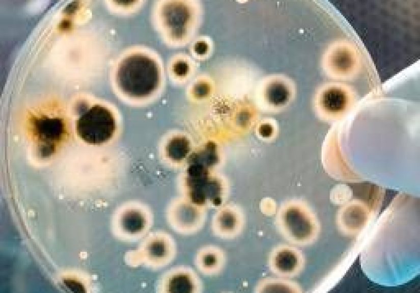 Wearing antiperspirant, deodorant significantly alters armpit bacteria