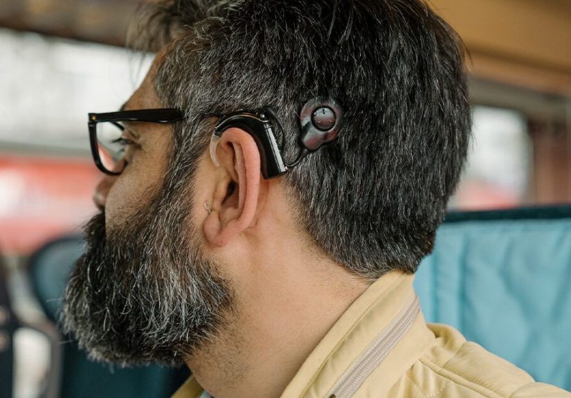 Why Cochlear Implants Are Bad: Exploring the Controversy