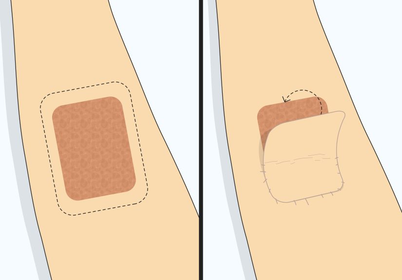 3 Simple Ways to Hide Scars on Your Arms