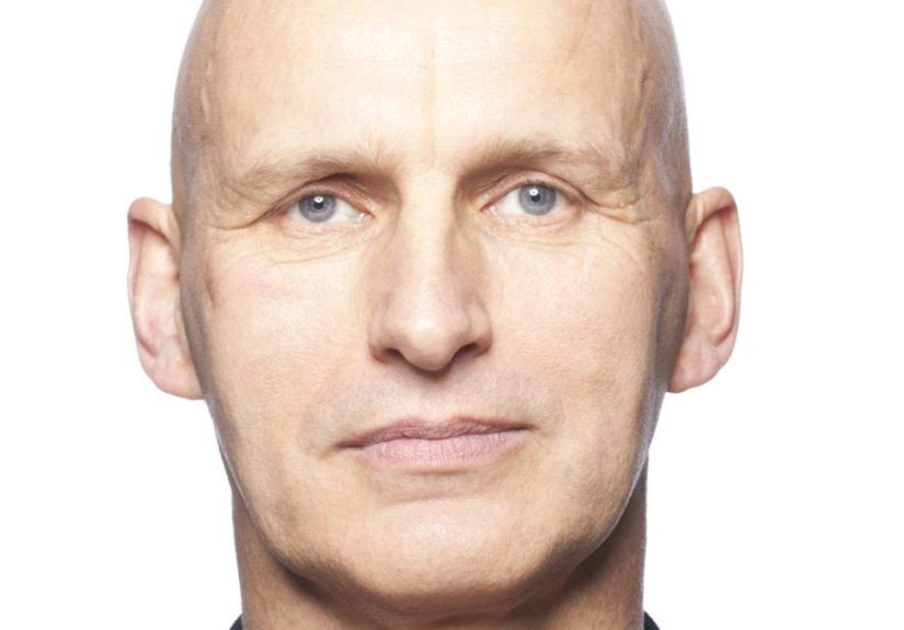 Alopecia universalis: Causes, treatment and hair regrowth