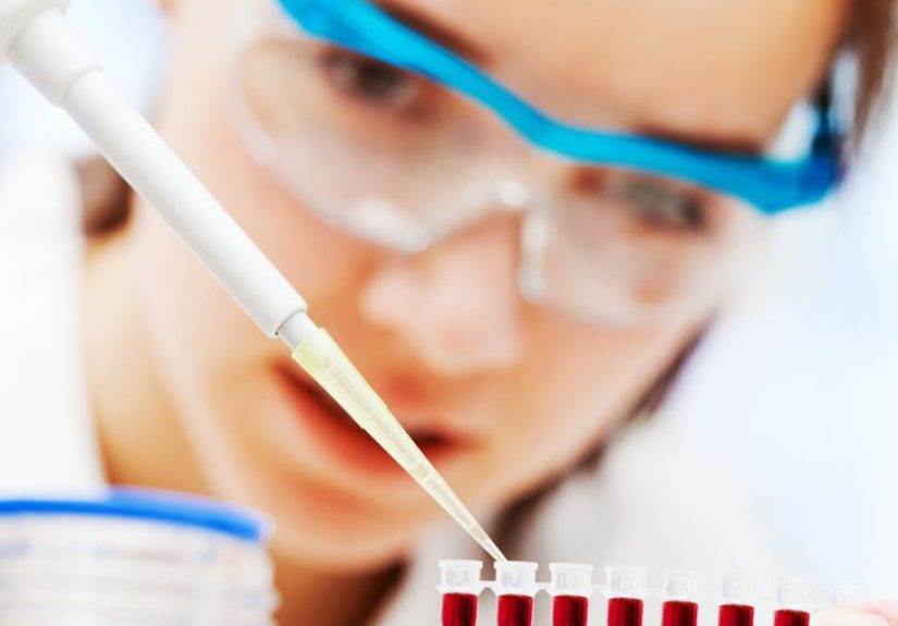 Amylase Lab Test for Pancreatitis: What It Is and More