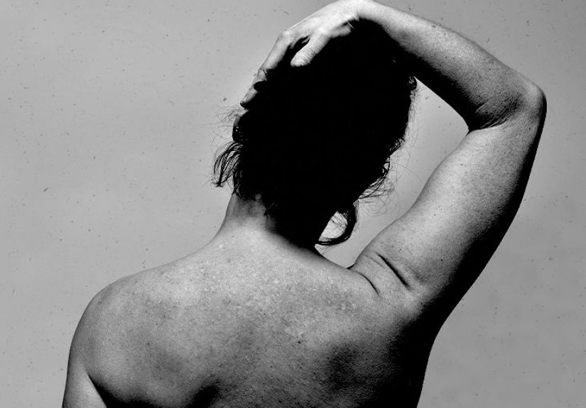 Autonomic dysreflexia: Overview, symptoms, and more