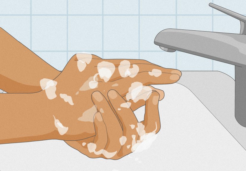 How to Pierce Ears with a Sewing Needle: 12 Steps? Here’s the Safer Answer