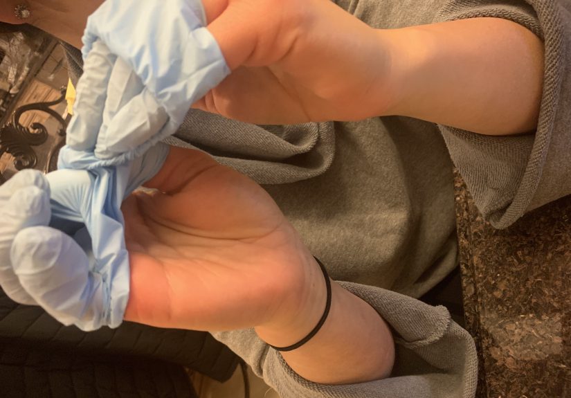 How to Prick a Finger for a Blood Spot Test