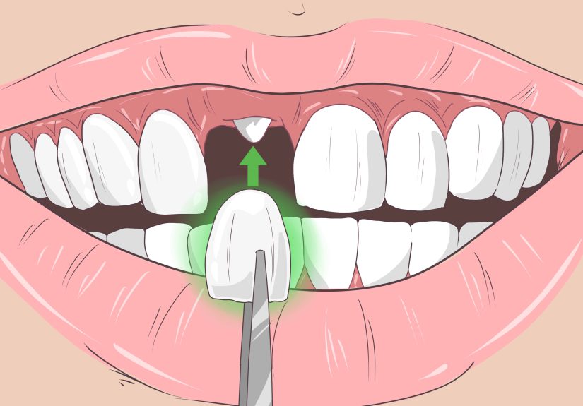 How to Remove Brown Stains from Teeth: 10 Proven Methods