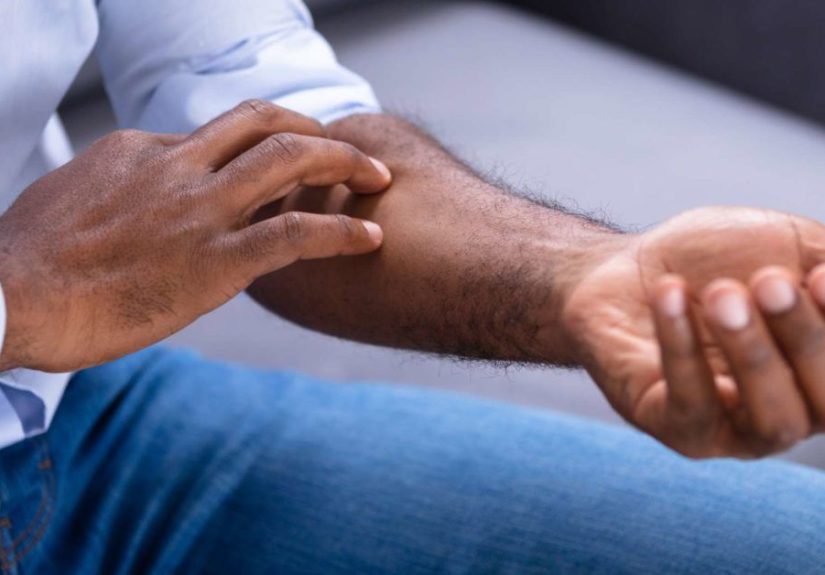 Qué es la disestesia, síntomas y tratamiento