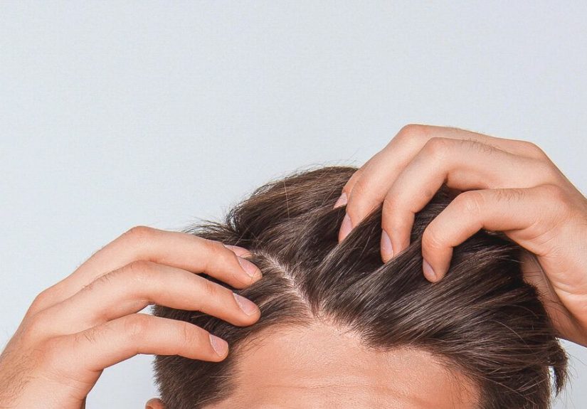Scabs and Sores on the Scalp: Causes and Treatments