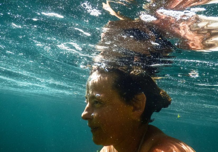 Vascular Parkinsonism: Symptoms, Causes, and Treatment