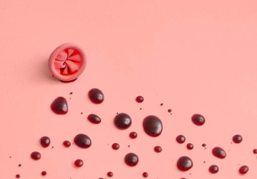 Why Am I Pooping Blood, But There’s No Pain?