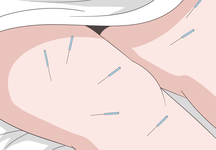 3 Easy Ways to Treat Numbness in Legs and Feet