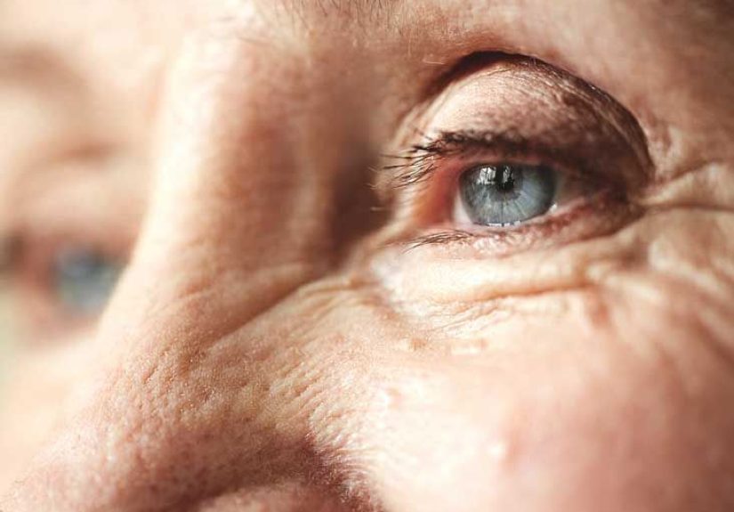 Blepharoplasty: Procedure, Efficacy, Safety, and More