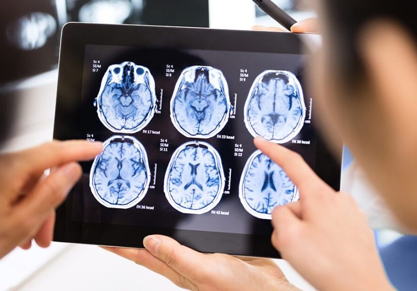 Brain Imaging Techniques: Types and Uses