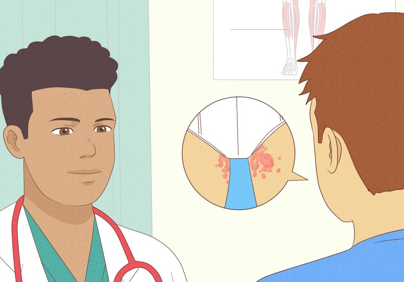 How to Get Rid of a Rash Between Your Legs: At-Home Treatments & More