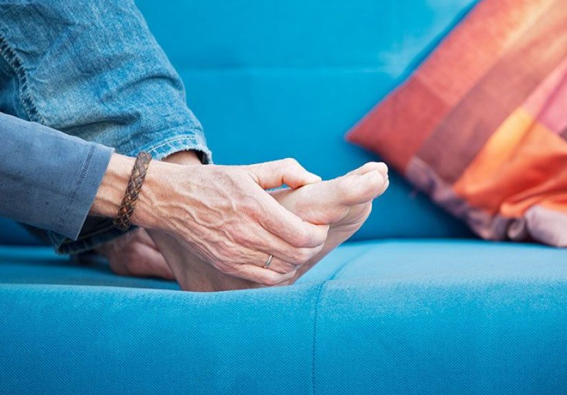 Hyperuricemia: Symptoms, Causes, and Treatment