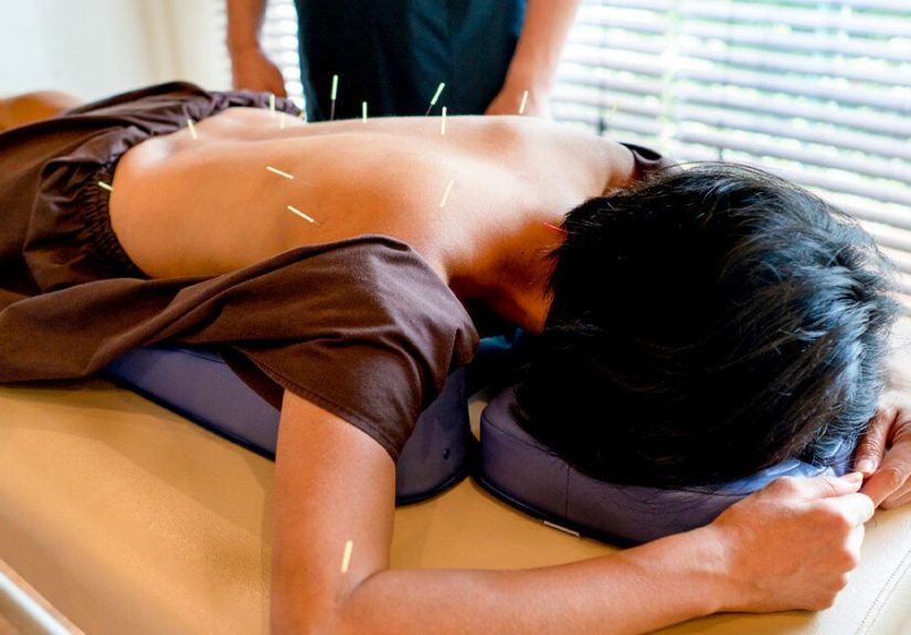 Is Acupuncture for Eczema Effective?