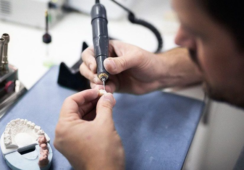 Psoriatic arthritis and dental implants: Procedure and risks
