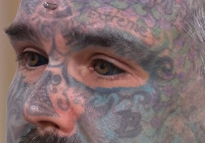 “Total Stupidity!”: Man Who Got His Eyeballs Tattooed Reveals Dangerous Process
