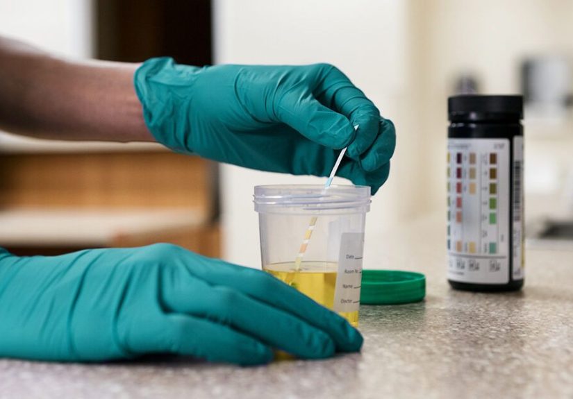 Trace Ketones in Your Urine: Causes, When to Be Concerned, and More