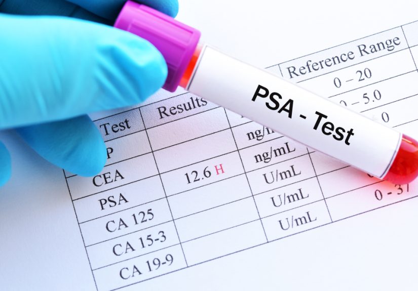 When Medicare Stops Covering a Test Without Warning